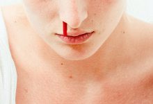 Фото - Москвичка укусила за нос напавшего на нее мужчину