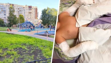 Фото - В Ленобласти мальчик упал на детской площадке и сломал руки
